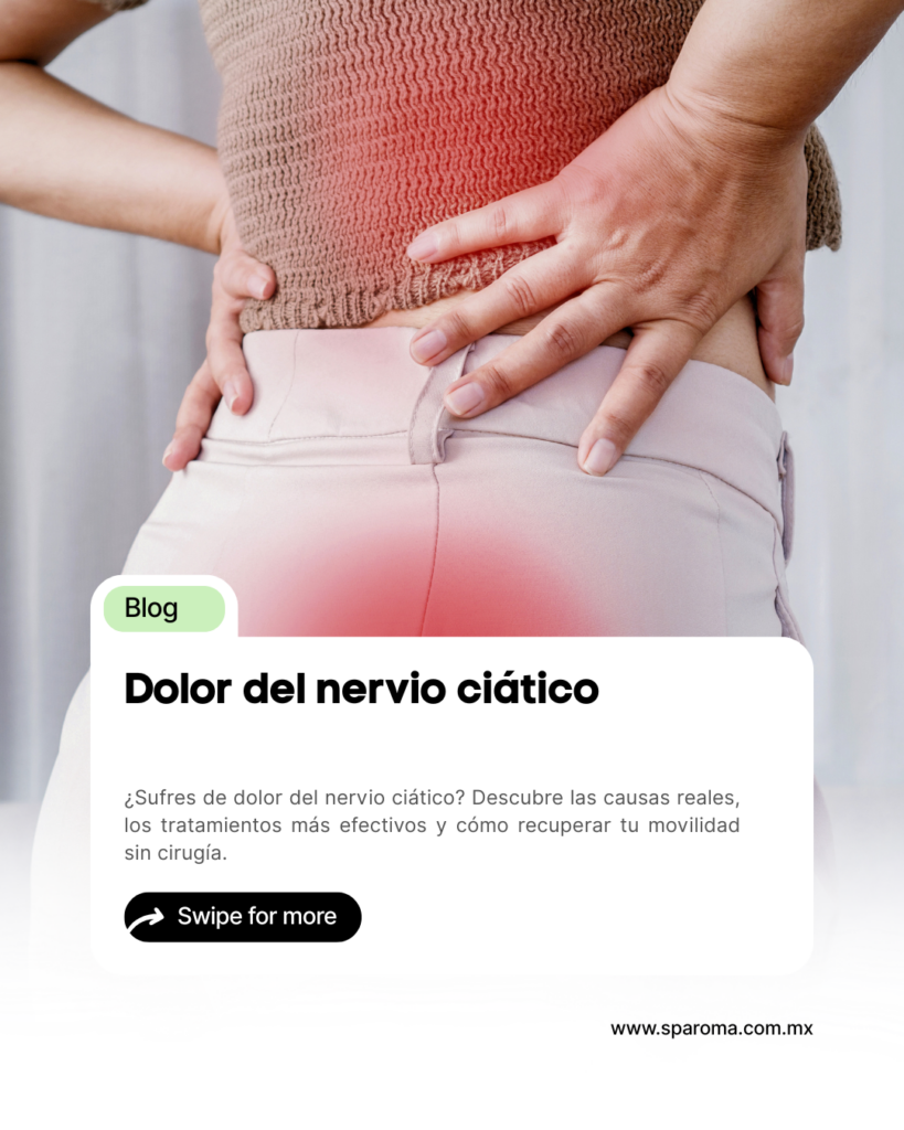 Dolor del nervio ciático