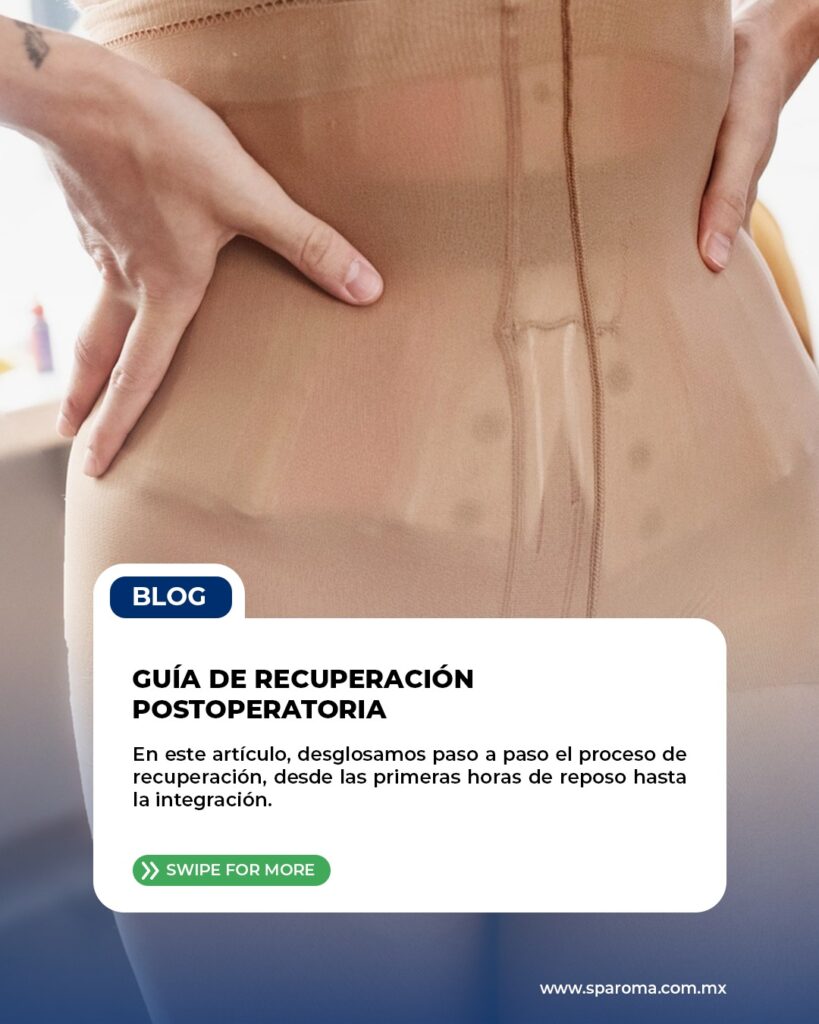 Guía de Recuperación Postoperatoria