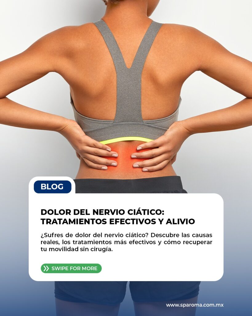 Dolor del nervio ciático