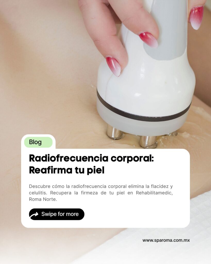 Radiofrecuencia corporal